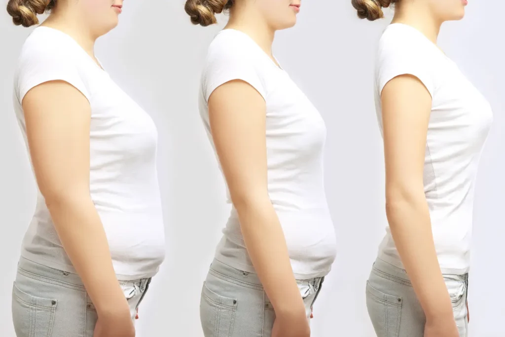 Weight Loss with GLP-1